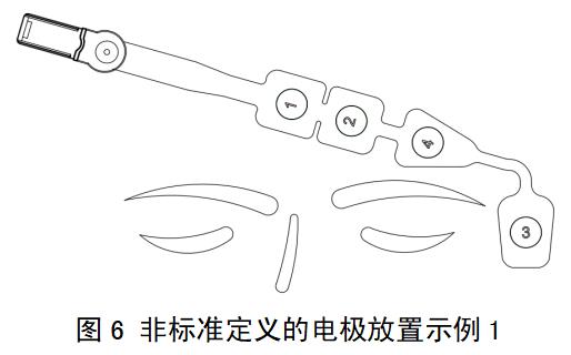 一次性使用腦電電極注冊審查指導(dǎo)原則（2022年第35號）(圖5)